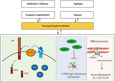 Alzheimer’s disease and epilepsy: An increasingly recognized comorbidity